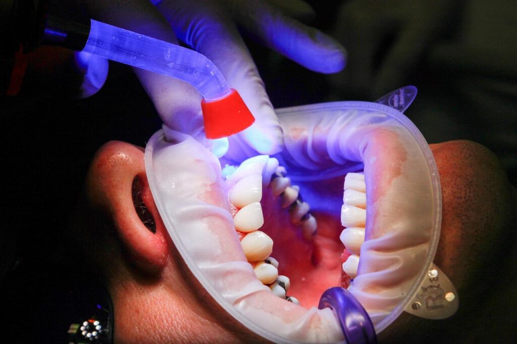 Gelukkige patiënt toont verbeterde glimlach na orthodontische behandeling bij orthodontist in Leiden